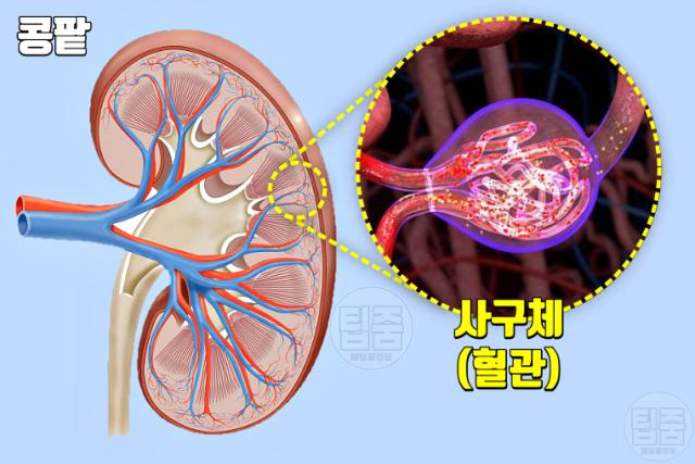 신장에 안좋은 습관 짜게먹기 싱겁게먹기