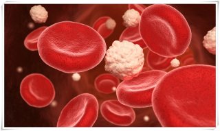 혈당 스파이크란?