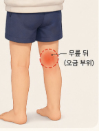 Pain and growing pains in the back of the knee cause, intensity of pain, and arrangement of treatments