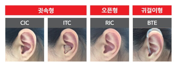 보청기 국가보조금지원
