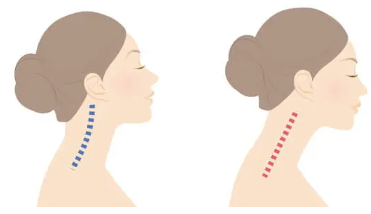 스마트폰 목의 원인