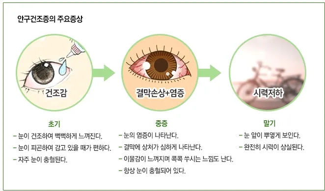 눈이 시린이유