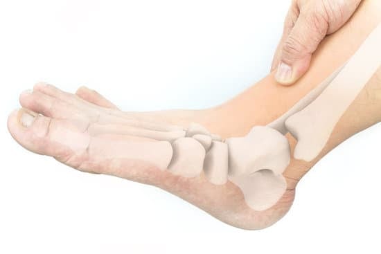 뼈 유합 실패 (Nonunion) &ndash; 원인, 증상 &amp; 치료 방법