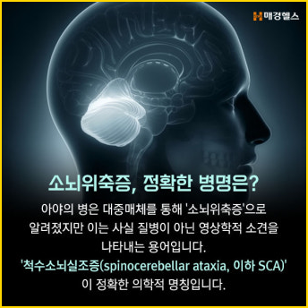 소뇌위축증 증상 원인 5가지, 꼭 알아야 할 것