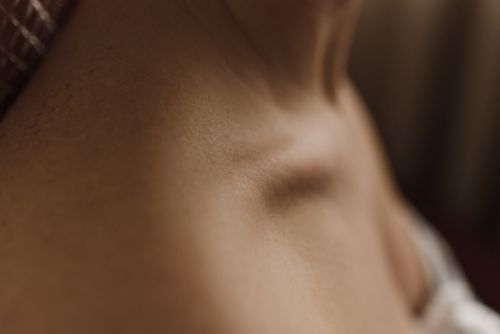 땀띠와 습진 차이 완벽 정리: 가려움&middot;발진&middot;진물로 구별하는 법