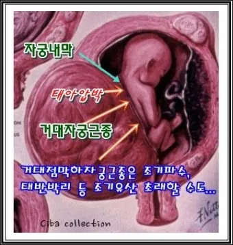 출산 후 자궁수축 기간_22