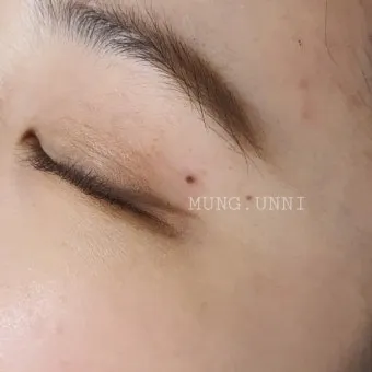 눈과 눈사이 점 관상 의미와 해석_7
