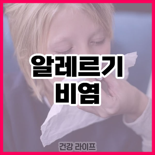 알레르기 비염