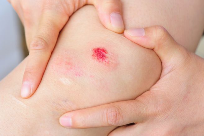 염증수치가 높은 이유