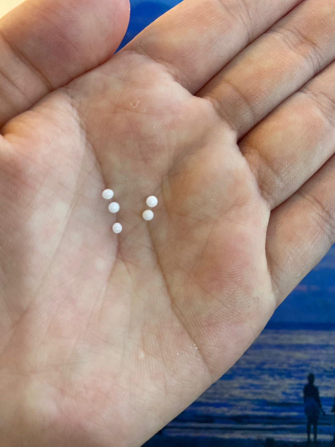 공포의 이앓이 완화방법 3가지 ❘ 냉동 치발기, 잇몸마사지, 이앓이 캔디