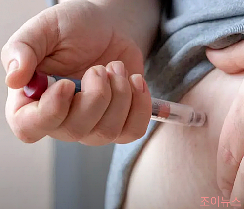 투약 방법 및 주사 방법