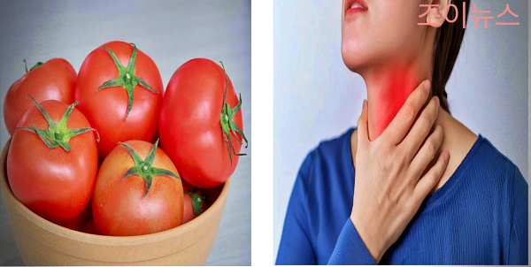 토마토 식품알레르기 증상
