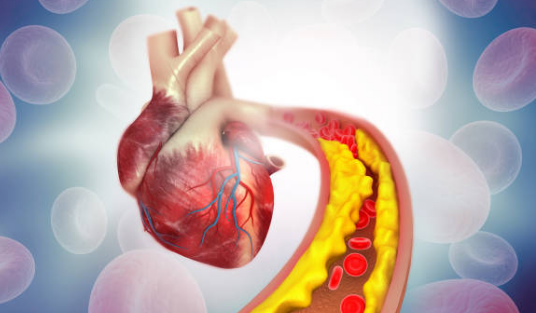 고지혈증 증상, 고지혈증에 좋은 음식, 고지혈증 수치 총정리 (2024ver)