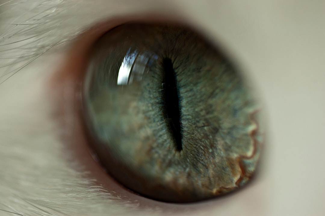 Cataract