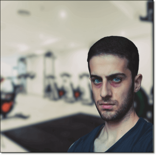 외상으로 인한 삼차신경통