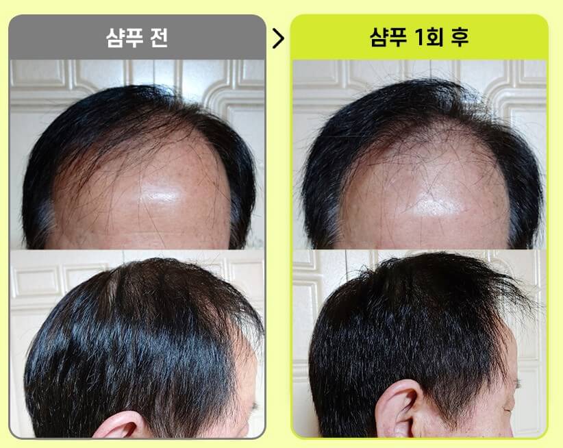 그래비티-샴푸-사용시-효과를-본-전-후-사진입니다.