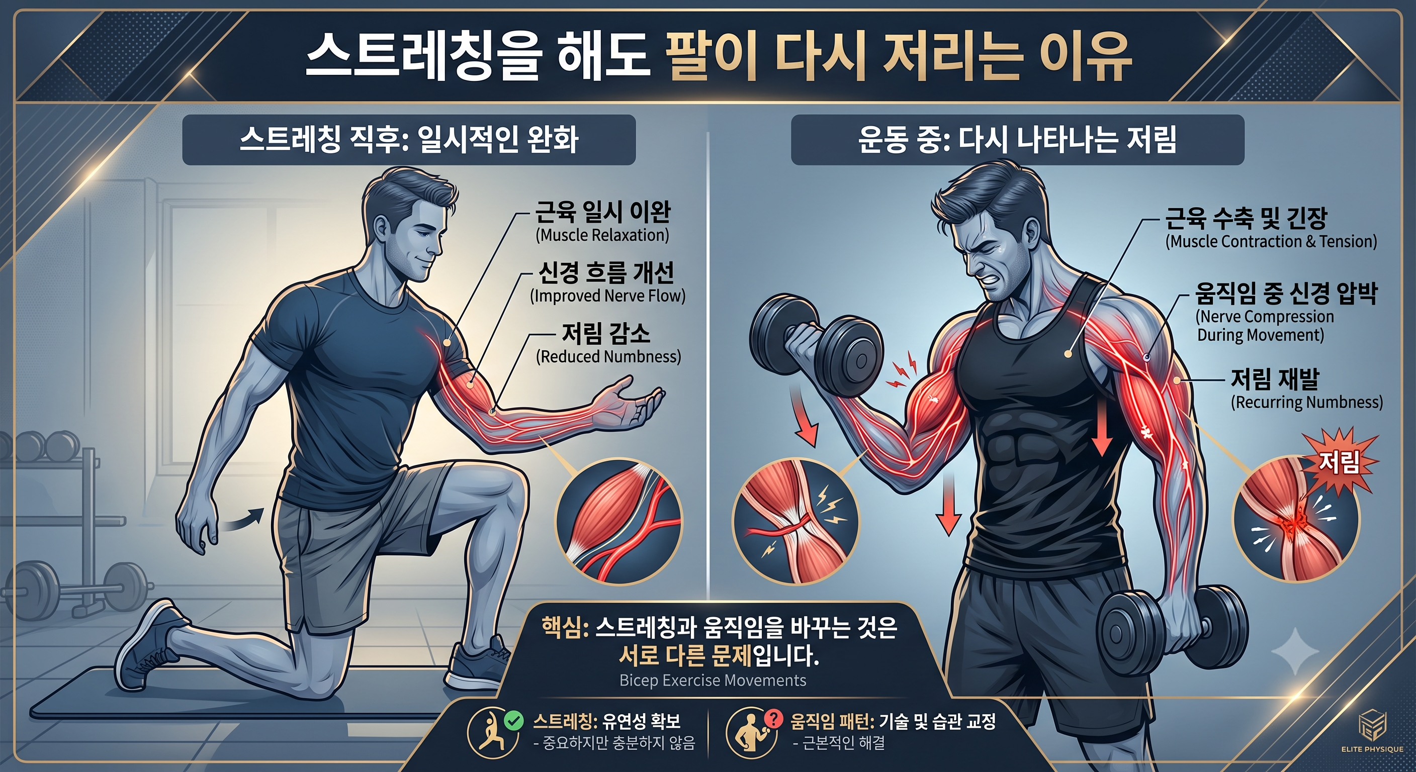 스트레칭을 해도 팔이 다시 저리는 이유