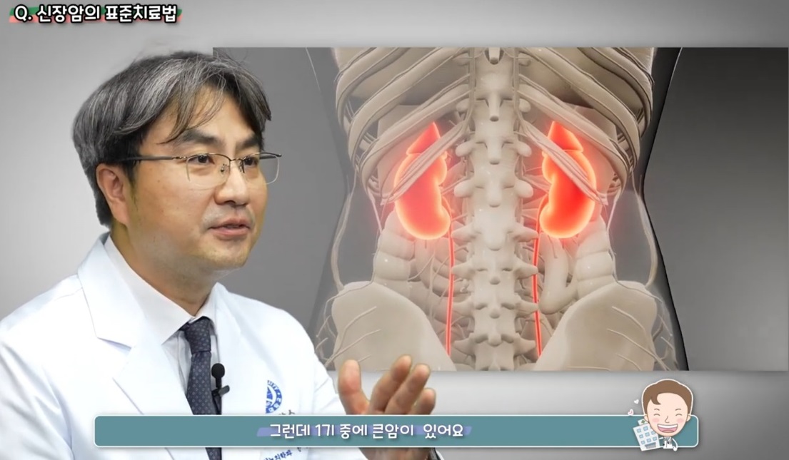 EBS명의-신장암-한웅규-교수