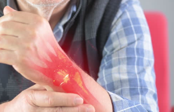 손목 터널 증후군