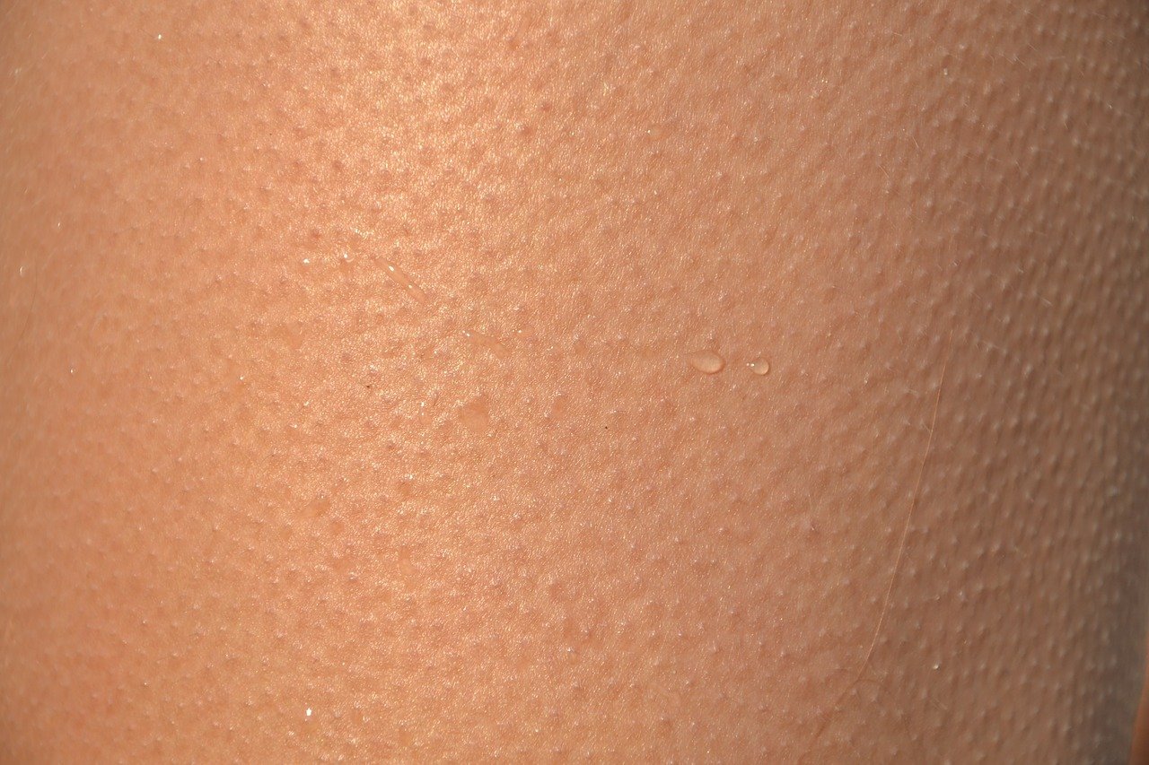 “모공-각화증-원인”