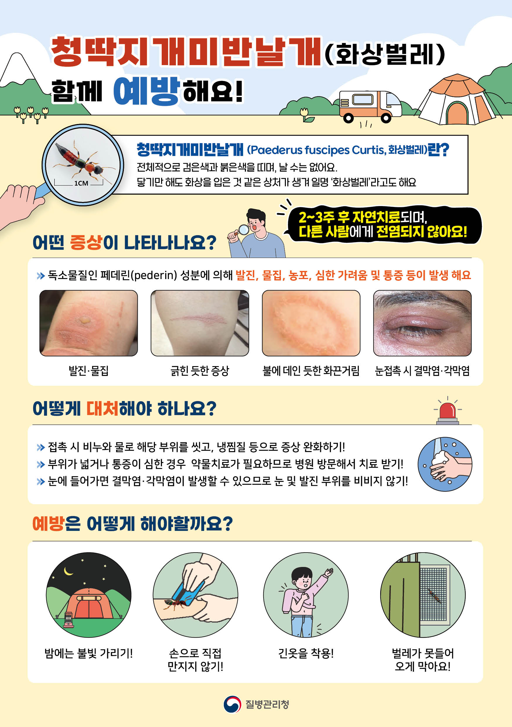 청딱지개미반날개 화상벌레 증상 및 예방법