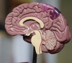 치매에 좋은 음식 영양제 식단