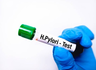 헬리코박터-파일로리-의심-신호-검사-가이드