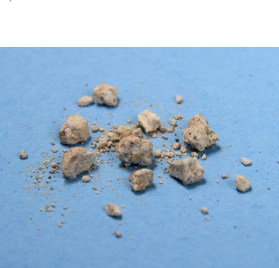 요로결석의 형태를 나타낸 사진