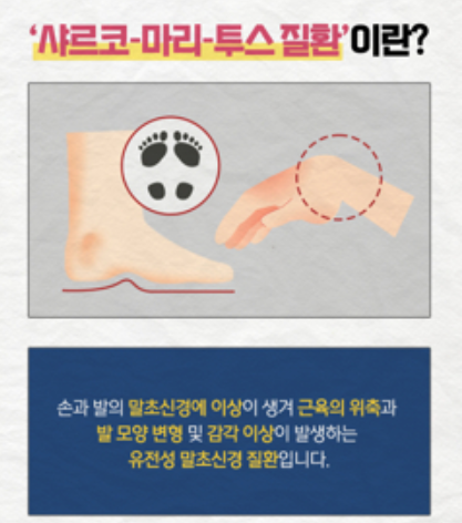 샤르코마리투스