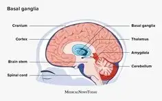 뇌졸중 귀주름으로 뇌졸중을 예측할 수 있나요?