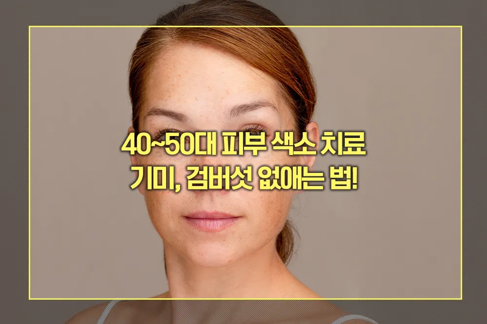 기미, 검버섯 없애는 법