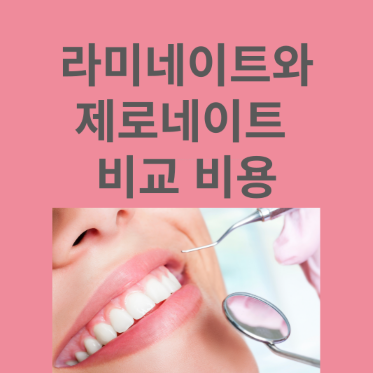 라미네이트와 제로네이트 비교 비용