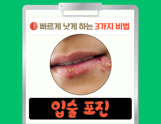 입술 포진, 이제는 두렵지 않아! 빨리 낫고 예방하는 완벽 가이드