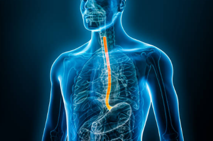 역류성 식도염에 좋은 음식&amp;#44; 증상&amp;#44; 자연치료 방법 총정리 (2024ver)