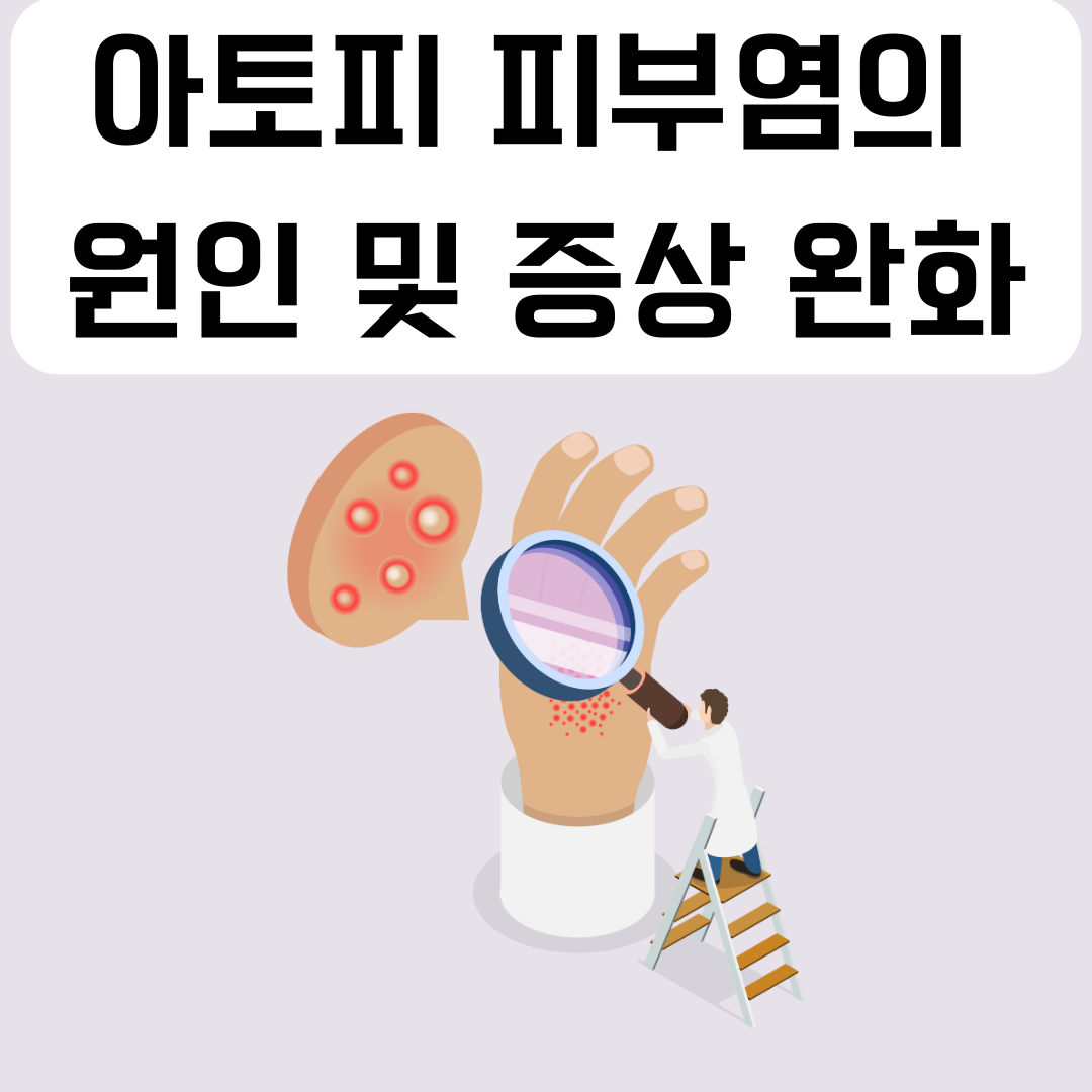 아토피-피부염-원인-증상-완화