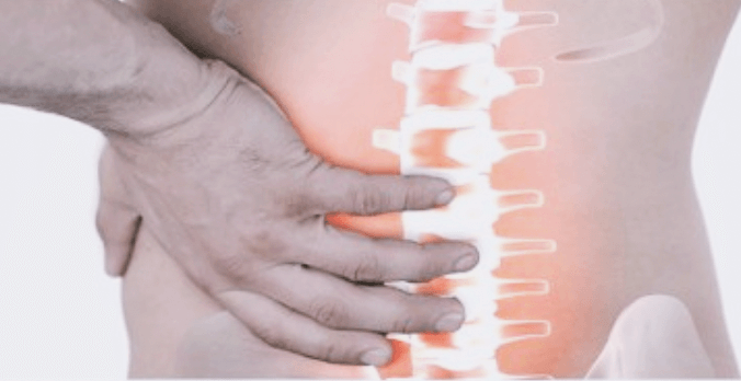 허리-통증으로-고통받는-사람