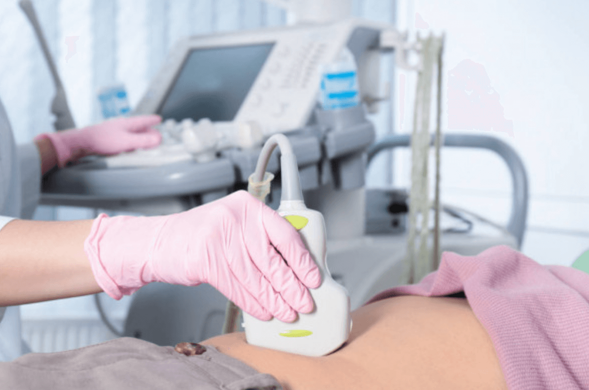 과민성-대장증후군-검사