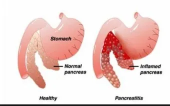 강아지 췌장암 증상 진단 치료법 안내_22