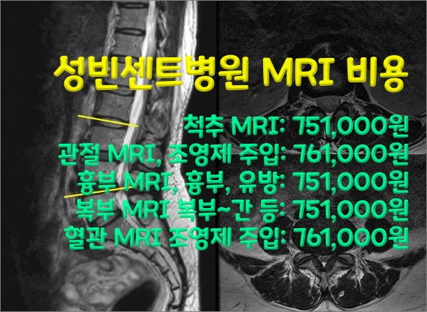 성빈센트병원-MRI-비용