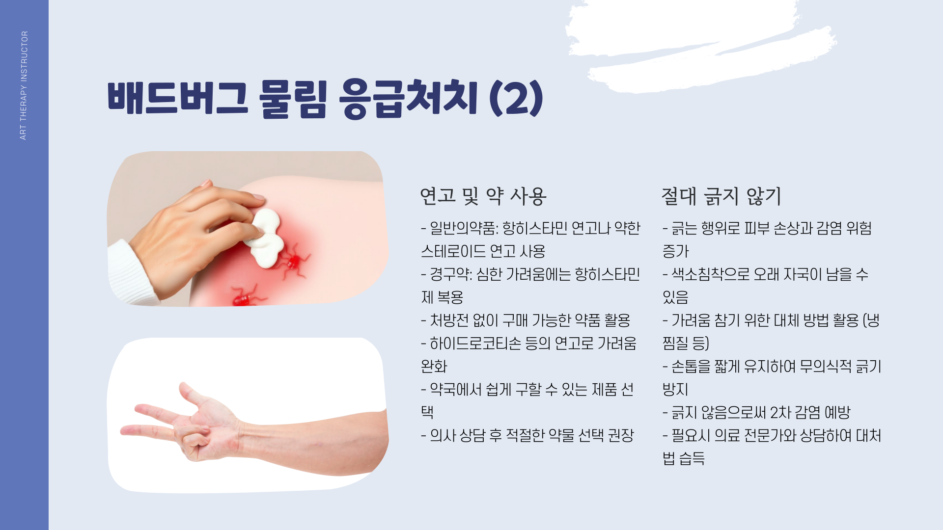 배드버그-치료방법