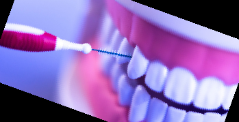 잇몸 내려앉음 치료