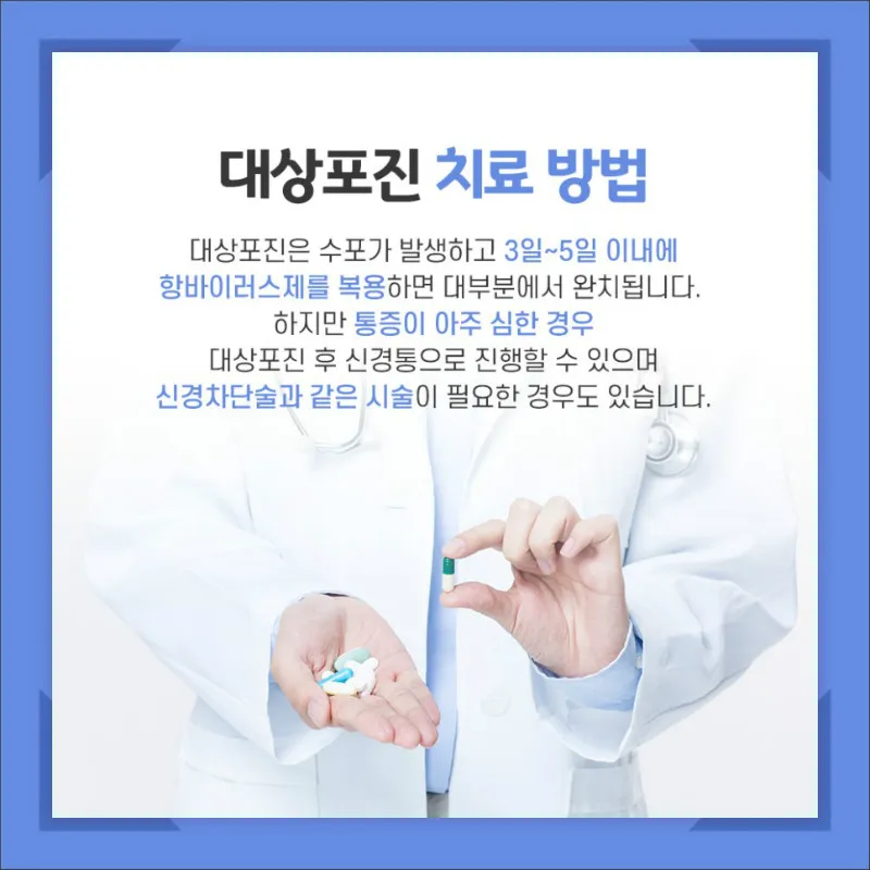 대상포진 치료방법에 대한 총정리 건강 질병관리_6
