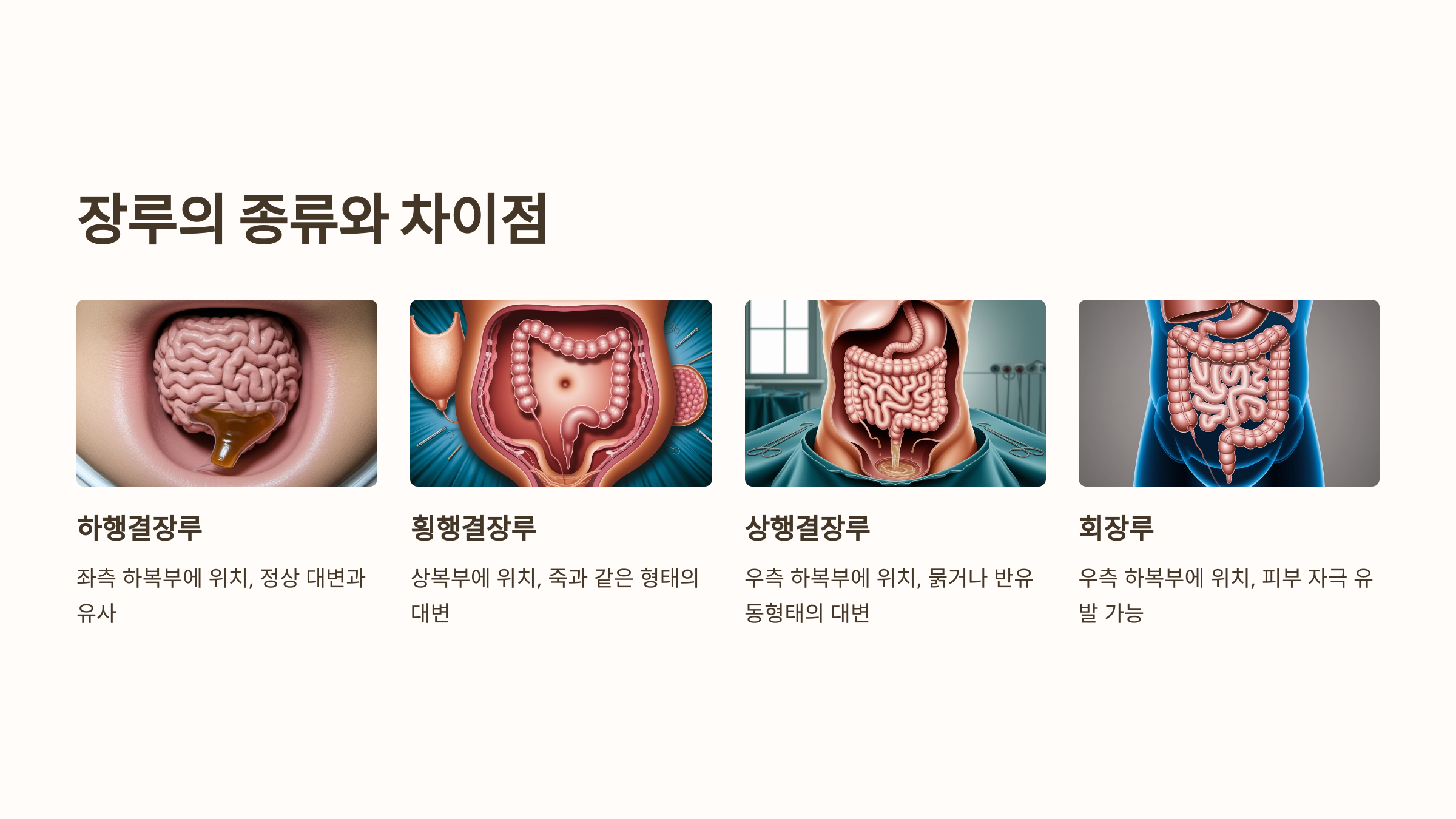 장루 종류와 차이점