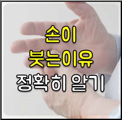 손이 붓는 이유-1