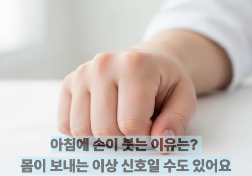 아침에 손이 붓는 이유는? 몸이 보내는 이상 신호일 수도 있어요