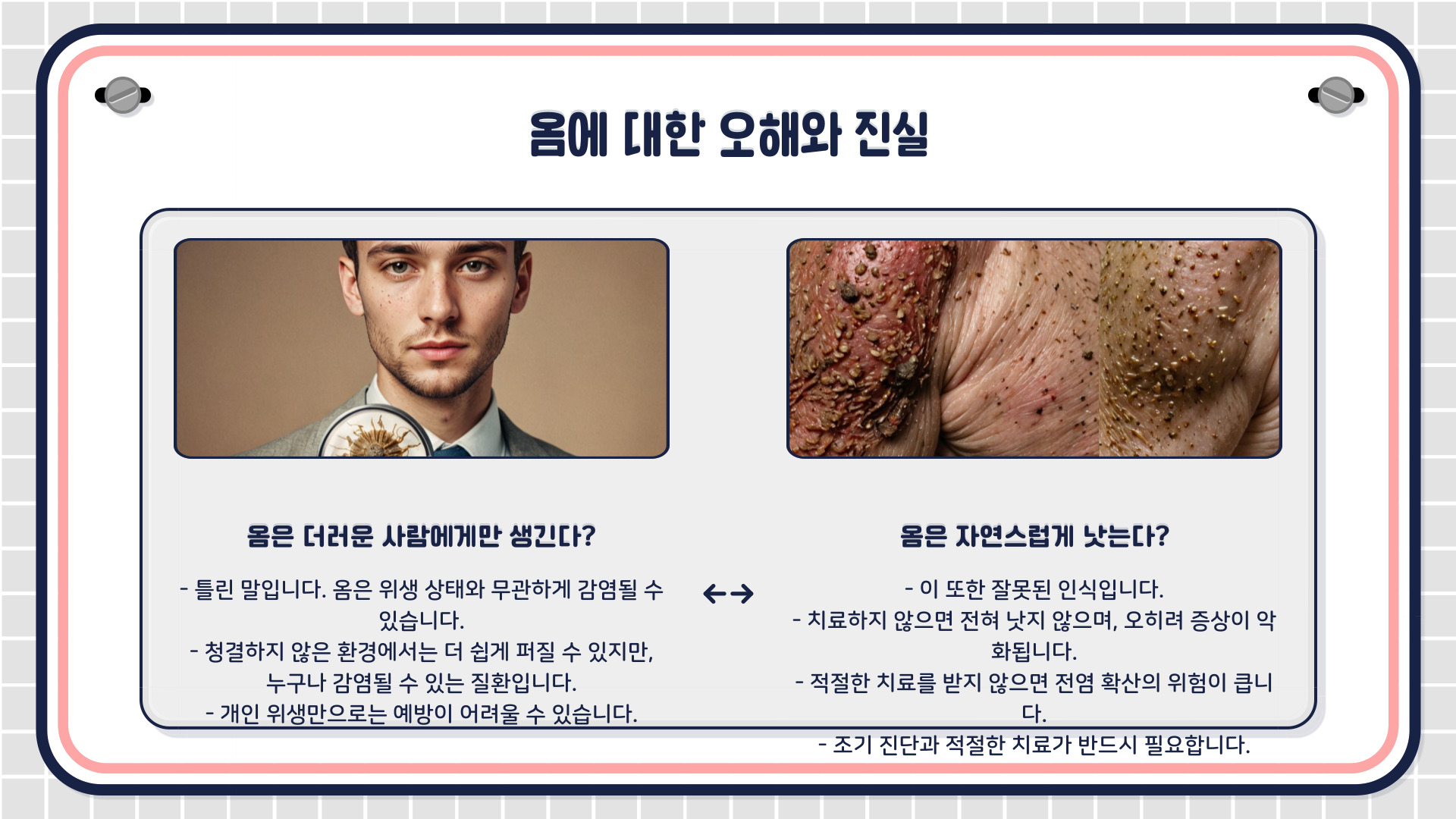 옴 증상