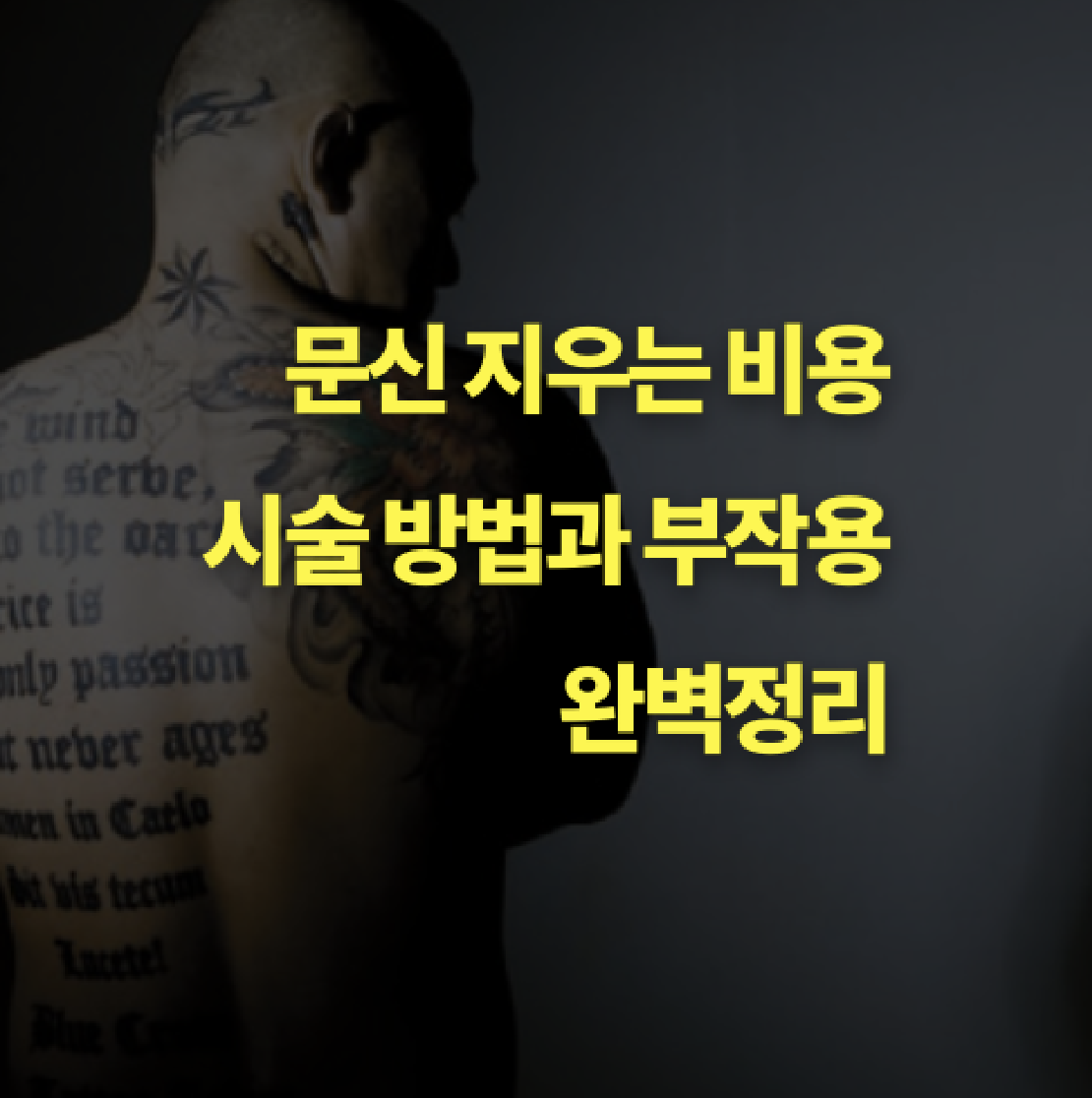 문신 지우는 비용, 시술 방법, 부작용까지 완벽 정리