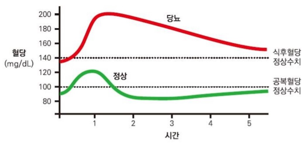 혈당 정상수치 식후 혈당 관리 방법