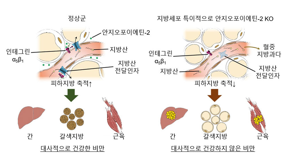 alt=" 건강한 비만과 건강하지 않는비만비교"
