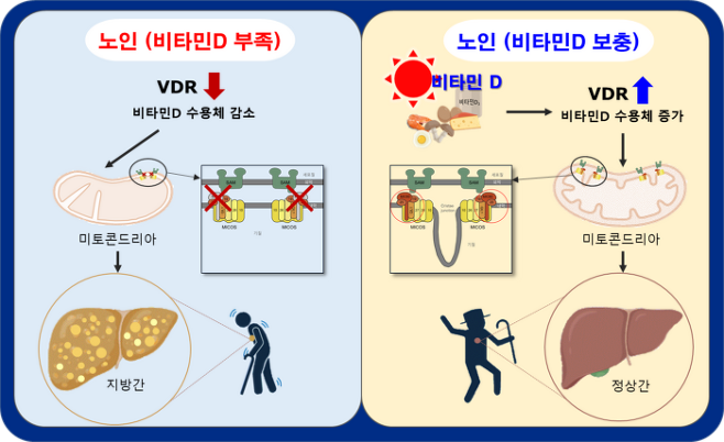 비타민D - 비알콜성 지방간 억제 최초 규명&#44; 출처 - 질병관리청